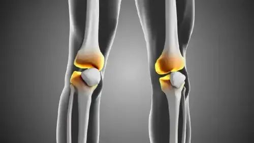 What are the Medical Approaches to Treating a Knee Joint Gap?